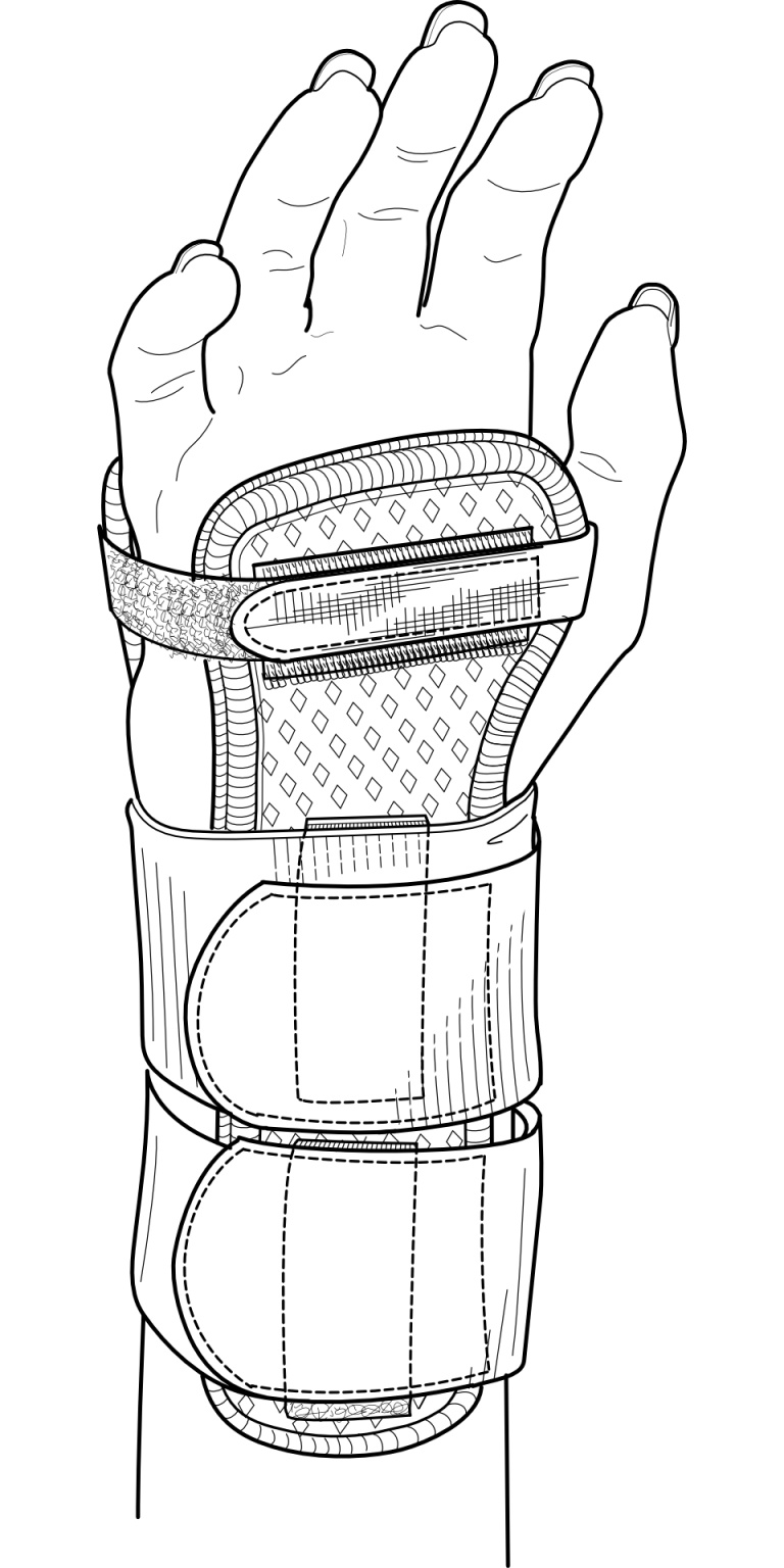 How To Use A SAM Splint Common Techniques (with pictures)!